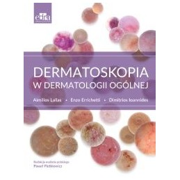 Dermatoskopia w...