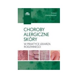 Choroby alergiczne skóry w...