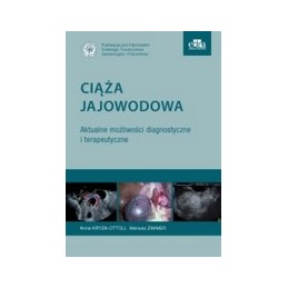Ciąża jajowodowa