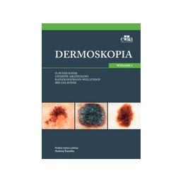Dermoskopia