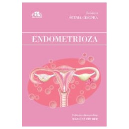 Endometrioza