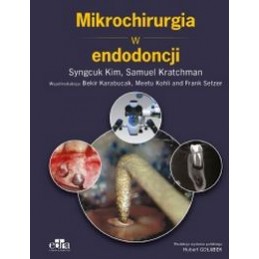 Mikrochirurgia w endodoncji