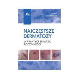 Najczęstsze dermatozy w...