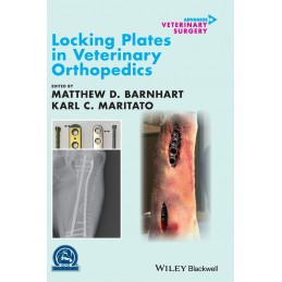 Locking Plates in...