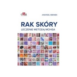 Rak skóry. Leczenie metodą...
