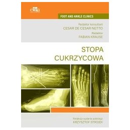 Stopa cukrzycowa