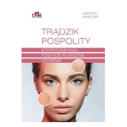 Trądzik pospolity