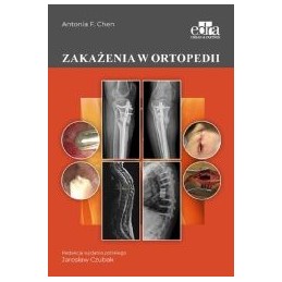 Zakażenia w ortopedii