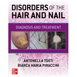 Disorders of the Hair and Nail: Diagnosis and Treatment Disorders of the Hair and Nail: Diagnosis and Treatment