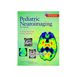 Pediatric Neuroimaging