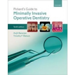 Pickard's Guide to...