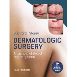 Dermatologic Surgery, 2nd Edition