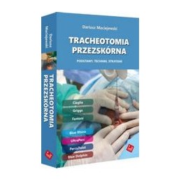 Tracheotomia przezskórna