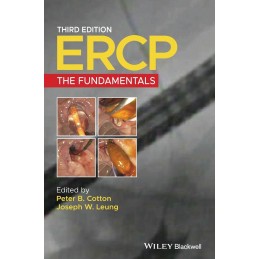 Ercp: The Fundamentals