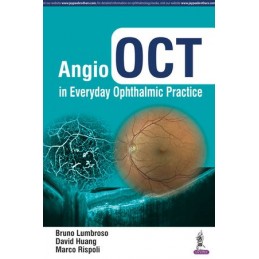 Angio OCT in Everyday...