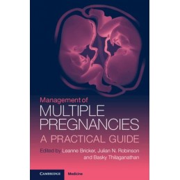 Management of Multiple...