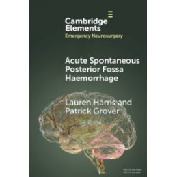 Acute Spontaneous Posterior...