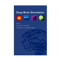 Deep Brain Stimulation