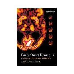 Early-Onset Dementia