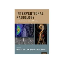 Interventional Radiology