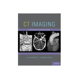 CT Imaging