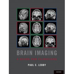 Brain Imaging