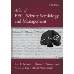 Atlas of EEG, Seizure Semiology, and Management