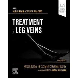 Procedures in Cosmetic Dermatology Series: Treatment of Leg Veins