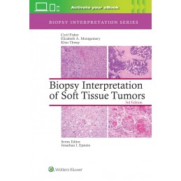Biopsy Interpretation of...
