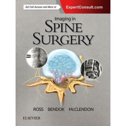 Imaging in Spine Surgery