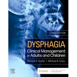 Dysphagia Dysphagia