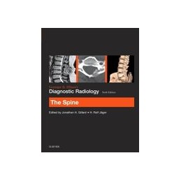 Grainger & Allison's Diagnostic Radiology: The Spine Grainger & Allison's Diagnostic Radiology: The Spine