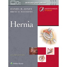 Master Techniques in Surgery: Hernia: Print + digital version with Multimedia