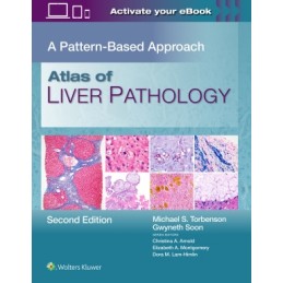 Atlas of Liver Pathology: A Pattern-Based Approach