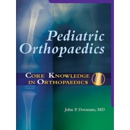 Core Knowledge in Orthopaedics: Pediatric Orthopaedics