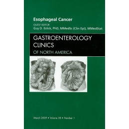 Esophageal Cancer, An Issue...