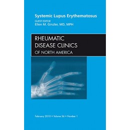 Systemic Lupus Erythematosus, An Issue of Rheumatic Disease Clinics
