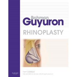 Rhinoplasty