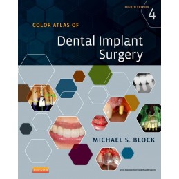 Color Atlas of Dental Implant Surgery