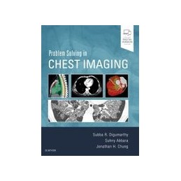 Problem Solving in Chest Imaging