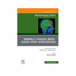 Spine Intervention, An...