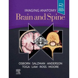 Imaging Anatomy Brain and...