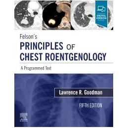 Felson's Principles of...