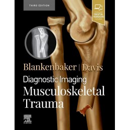 Diagnostic Imaging: Musculoskeletal Trauma Diagnostic Imaging: Musculoskeletal Trauma