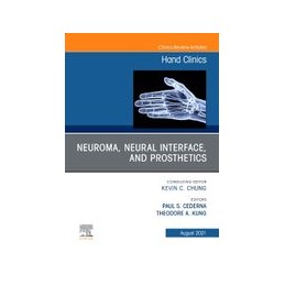 Neuroma, Neural Interface,...