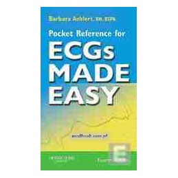Pocket Reference for ECGs...