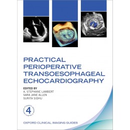Practical Perioperative Transoesophageal Echocardiography