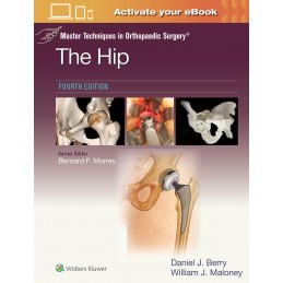Master Techniques in Orthopaedic Surgery: The Hip: Print + digital version with Multimedia