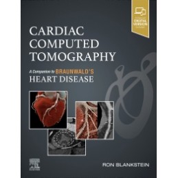 Cardiac Computed Tomography
