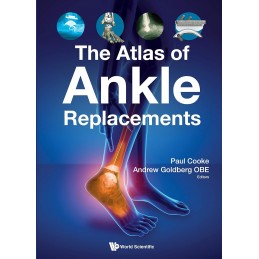 Atlas Of Ankle Replacements